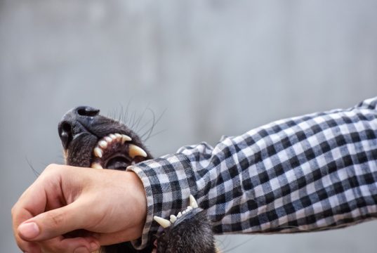 Dog Bite Law Explained: Liability, Victim Rights, and California’s Strict Legal Framework